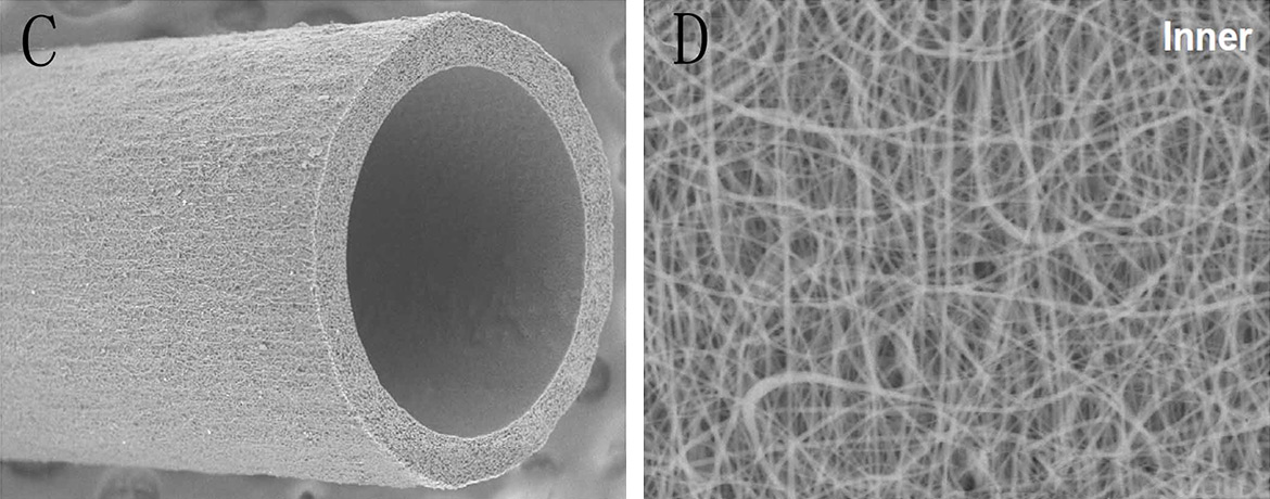 structural and mechanical characterization of nanofibous PCU vascular graft